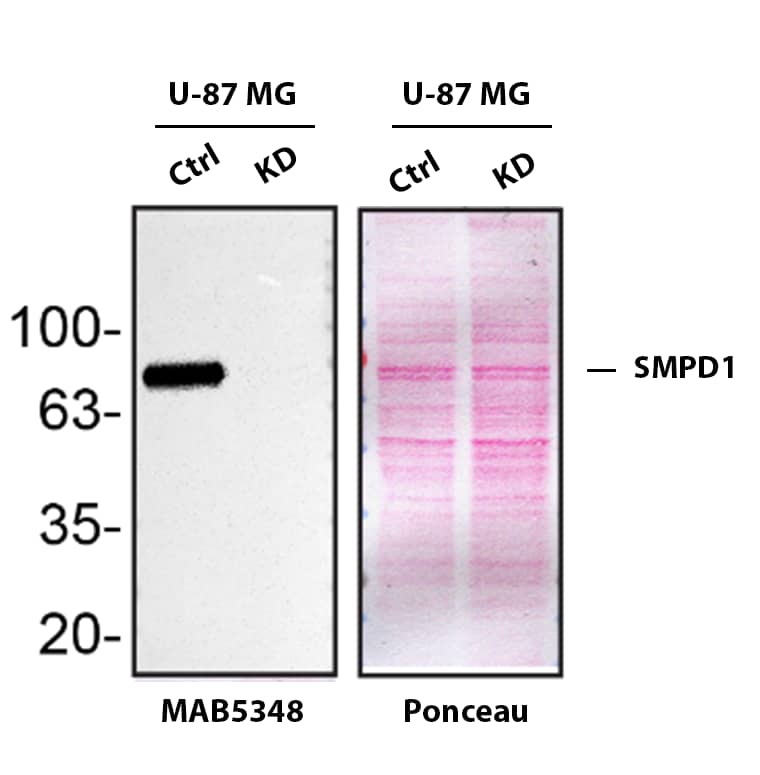 Knockdown Validated SMPD1 Antibody (563418) [Unconjugated]