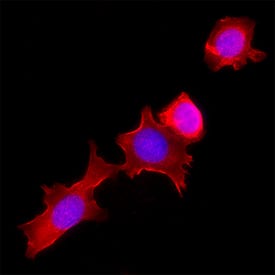 Immunohistochemistry ADAM32 Antibody (539220) [Unconjugated]