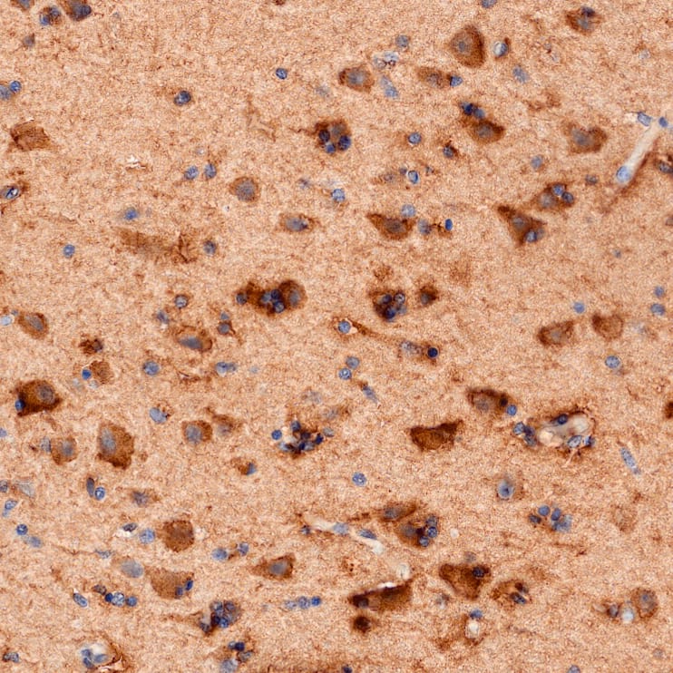 Immersion fixed paraffin-embedded sections of hippocampus