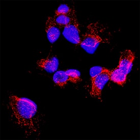 Carboxylesterase 2/CES2 was detected in immersion fixed A431 human epithelial carcinoma cell line using Mouse Anti-Human Carboxylesterase 2/CES2 Monoclonal Antibody (Catalog # MAB56571) at 8 &micro;g/mL for 3 hours at room temperature. Cells were stained using the NorthernLights&trade; 557-conjugated Anti-Mouse IgG Secondary Antibody (red; NL007) and counterstained with DAPI (blue). Specific staining was localized to cytoplasm. Staining was performed using our Fluorescent ICC Staining of Cells on Coverslips Protocol.