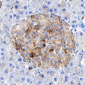 Reg3D was detected in immersion fixed paraffin-embedded sections of mouse pancreas using Rat Anti-Mouse Reg3D Monoclonal Antibody (Catalog # MAB5678) at 15 µg/ml for 1 hour at room temperature followed by incubation with the Anti-Rat IgG VisUCyte&trade; HRP Polymer Antibody (Catalog # VC005) or the HRP-conjugated Anti-Rat IgG Secondary Antibody (Catalog # HAF005). Before incubation with the primary antibody, tissue was subjected to heat-induced epitope retrieval using VisUCyte Antigen Retrieval Reagent-Basic (Catalog # VCTS021). Tissue was stained using DAB (brown) and counterstained with hematoxylin (blue). Specific staining was localized to pancreatic islets. View our protocol for Chromogenic IHC Staining of Paraffin-embedded Tissue Sections.