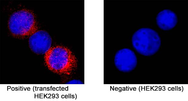 GFR alpha ‑like was detected in immersion fixed HEK293 human embryonic kidney cell line transfected (positive staining) and HEK293 human embryonic kidney cell line (non-transfected, negative staining) using Rat Anti-Mouse GFR alpha ‑like Monoclonal Antibody (Catalog # MAB5728) at 8 µg/mL for 3 hours at room temperature. Cells were stained using the NorthernLights™ 557-conjugated Anti-Rat IgG Secondary Antibody (red; NL013)  and counterstained with DAPI (blue). Specific staining was localized to cytoplasm. Staining was performed using our protocol for Fluorescent ICC Staining of Non-adherent Cells.