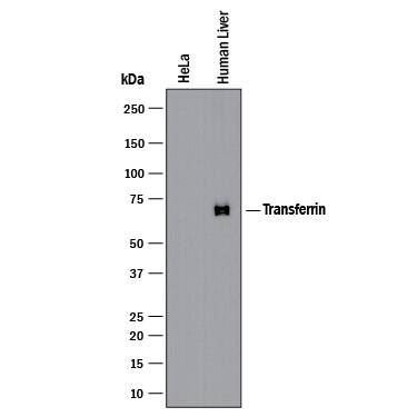 Western blot shows lysates of HeLa human cervical epithelial carcinoma cell line (negative control) and human liver. PVDF membrane was probed with 2 µg/mL of Mouse Anti-Human Transferrin Monoclonal Antibody (Catalog # MAB5746) followed by HRP-conjugated Anti-Mouse IgG Secondary Antibody (HAF018). A specific band was detected for Transferrin at approximately 67-70 kDa (as indicated). This experiment was conducted under non-reducing conditions and using Western Blot Buffer Group 1.