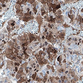 Arginase 1/ARG1 was detected in immersion fixed paraffin-embedded sections of human liver cancer using Mouse Anti-Human Arginase 1/ARG1 Monoclonal Antibody (Catalog # MAB5868) at 1 µg/ml overnight at 4 °C. Before incubation with the primary antibody, tissue was subjected to heat-induced epitope retrieval using VisUCyte Antigen Retrieval Reagent-Basic (Catalog # VCTS021). Tissue was stained using the HRP-conjugated Anti-Mouse IgG Secondary Antibody (Catalog # HAF007) and counterstained with hematoxylin (blue). Specific staining was localized to the nucleus and cytoplasm. View our protocol for Chromogenic IHC Staining of Paraffin-embedded Tissue Sections.