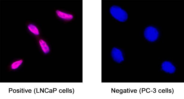 Androgen R/NR3C4 was detected in immersion fixed LNCaP human prostate cancer cell line (left panel; positive staining) and PC‑3 human prostate cancer cell line (right panel; negative staining) using Rabbit Anti-Human Androgen R/NR3C4 Monoclonal Antibody (Catalog # MAB58762) at 8 µg/mL for 3 hours at room temperature. Cells were stained using the NorthernLights™ 557-conjugated Anti-Rabbit IgG Secondary Antibody (red; NL004) and counterstained with DAPI (blue). Specific staining was localized to the nucleus. Staining was performed using our protocol for Fluorescent ICC Staining of Non-adherent Cells.