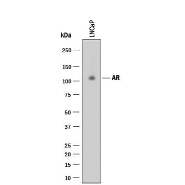 Western Blot Androgen R/NR3C4 Antibody (2621E) [Unconjugated]