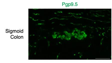 1:100 dilution in PFA-fixed, frozen human sigmoid colon. 0.2% Triton X-100 was included in primary antibody mix. Image from a verified customer review.