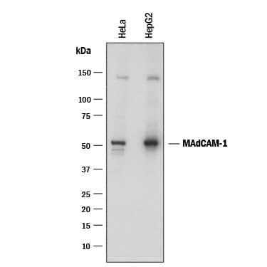 Western Blot MAdCAM-1 Antibody (683715) [Unconjugated]