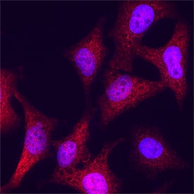 Importin  alpha 2/KPNA2 was detected in immersion fixed HeLa human cervical epithelial carcinoma cell line using Mouse Anti-Human Importin  alpha 2/KPNA2 Monoclonal Antibody (Catalog # MAB62071) at 25 &micro;g/mL for 3 hours at room temperature. Cells were stained using the NorthernLights&trade; 557-conjugated Anti-Mouse IgG Secondary Antibody (red; NL007) and counterstained with DAPI (blue). Specific staining was localized to cytoplasm. Staining was performed using our protocol for Fluorescent ICC Staining of Non-adherent Cells.