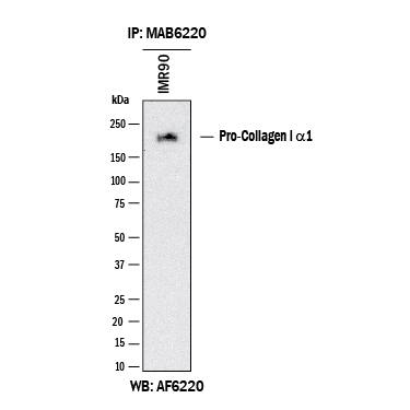 Human Pro-Collagen I alpha 1 was immunoprecipitated from 500 μg of IMR‑90 human lung fibroblast cell line lysates with 5 μg of Mouse Anti-Human Pro-Collagen I alpha 1 Monoclonal Antibody (Catalog # MAB6220). The N-Pro Collagen I-antibody complexes were absorbed using Protein A or Protein G. Immunoprecipitated human Pro-Collagen I alpha 1 was detected by Western blot using 1 μg/mL of Sheep Anti-Human Pro-Collagen I alpha 1 Antigen Affinity-purified Polyclonal Antibody (AF6220) under reducing conditions and using Western Blot Buffer Group 1.