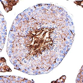CD39L2/ENTPD6 was detected in immersion fixed paraffin-embedded sections of Mouse Testis using Rat Anti-Mouse CD39L2/ENTPD6 Monoclonal Antibody (Catalog # MAB6288) at 5 µg/mL for 1 hour at room temperature followed by incubation with the Anti-Rat IgG VisUCyte™ HRP Polymer Antibody (Catalog # VC005). Before incubation with the primary antibody, tissue was subjected to heat-induced epitope retrieval using VisUCyte Antigen Retrieval Reagent-Basic (Catalog # VCTS021). Tissue was stained using DAB (brown) and counterstained with hematoxylin (blue). Specific staining was localized to cytoplasm in late spermatids. View our protocol for IHC Staining with VisUCyte HRP Polymer Detection Reagents.