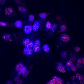 ONECUT2 was detected in immersion fixed HepG2 human hepatocellular carcinoma cell line using Mouse Anti-Human ONECUT2 Monoclonal Antibody (Catalog # MAB6294) at 10 µg/mL for 3 hours at room temperature. Cells were stained using the Northern-Lights™ 557-conjugated Anti-Mouse IgG Secondary Antibody (red; Catalog # NL007) and counterstained with DAPI (blue). Specific staining was localized to nuclei (punctate). View our protocol for Fluorescent ICC Staining of Cells on Coverslips.