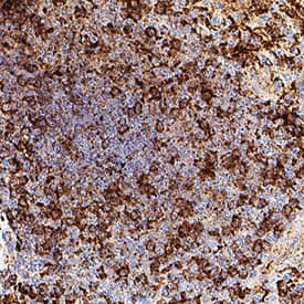 TRAIL R3/TNFRSF10C was detected in immersion fixed paraffin-embedded sections of human spleen using Mouse Anti-Human TRAIL R3/TNFRSF10C Monoclonal Antibody (Catalog # MAB6301) at 15 µg/ml for 1 hour at room temperature followed by incubation with the Anti-Mouse IgG VisUCyte™ HRP Polymer Antibody (Catalog # VC001) or the HRP-conjugated Anti-Mouse IgG Secondary Antibody (Catalog # HAF007). Before incubation with the primary antibody, tissue was subjected to heat-induced epitope retrieval using VisUCyte Antigen Retrieval Reagent-Basic (Catalog # VCTS021). Tissue was stained using DAB (brown) and counterstained with hematoxylin (blue). Specific staining was localized to the membrane. View our protocol for IHC Staining with VisUCyte HRP Polymer Detection Reagents.