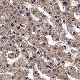 DNMT3A was detected in immersion fixed paraffin-embedded sections of human liver using Mouse Anti-Human DNMT3A Monoclonal Antibody (Catalog # MAB6315) at 3 &micro;g/mL for 1 hour at room temperature followed by incubation with the Anti-Mouse IgG VisUCyte&trade; HRP Polymer Antibody (VC001). Before incubation with the primary antibody, tissue was subjected to heat-induced epitope retrieval using Antigen Retrieval Reagent-Basic (CTS013). Tissue was stained using DAB (brown) and counterstained with hematoxylin (blue).  Specific staining was localized to cell nuclei. Staining was performed using our protocol for IHC Staining with VisUCyte HRP Polymer Detection Reagents.