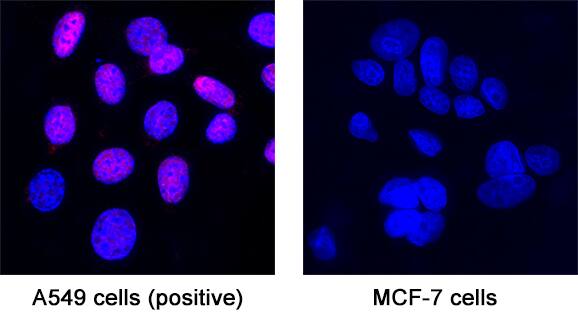 Immunocytochemistry TBX18 Antibody (635305) [Unconjugated]