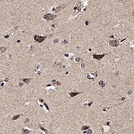 Immunohistochemistry Muscarinic Acetylcholine Receptor M3/CHRM3 Antibody (580011) [Unconjugated]