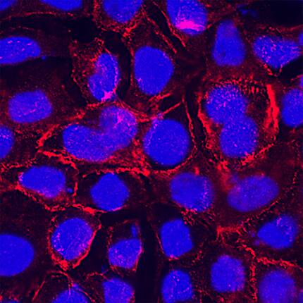ALCAM/CD166 was detected in immersion fixed A431 human epithelial carcinoma cell line using Rabbit Anti-Human ALCAM/CD166 Monoclonal Antibody (Catalog # MAB6563) at 3 &micro;g/mL for 3 hours at room temperature. Cells were stained using the NorthernLights&trade; 557-conjugated Anti-Rabbit IgG Secondary Antibody (red; NL004) and counterstained with DAPI (blue). Specific staining was localized to cell surface.Staining was performed using our Fluorescent ICC Staining of Cells on Coverslips Protocol.
