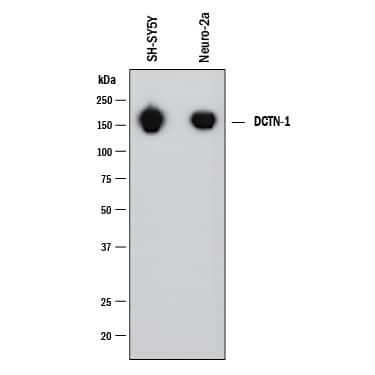Western blot shows lysates of SH‑SY5Y human neuroblastoma cell line and Neuro‑2A mouse neuroblastoma cell line. PVDF membrane was probed with 1 µg/mL of Mouse Anti-Human/Mouse Dynactin Subunit 1/DCTN1 Monoclonal Antibody (Catalog # MAB6657) followed by HRP-conjugated Anti-Mouse IgG Secondary Antibody (HAF018). A specific band was detected for Dynactin Subunit 1/DCTN1 at approximately 150 kDa (as indicated). This experiment was conducted under reducing conditions and using Western Blot Buffer Group 1.