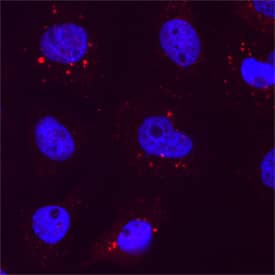 TAZ/WWTR1 was detected in immersion fixed A431 human epithelial carcinoma cell line using Mouse Anti-Human TAZ/WWTR1 Monoclonal Antibody (Catalog # MAB7210) at 25 &micro;g/mL for 3 hours at room temperature. Cells were stained using the NorthernLights&trade; 557-conjugated Anti-Mouse IgG Secondary Antibody (red; NL007) and counterstained with DAPI (blue). Specific staining was localized to cytoplasm. Staining was performed using our protocol for Fluorescent ICC Staining of Non-adherent Cells.