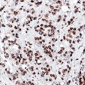 Bromodeoxyuridine/BrdU was detected in immersion fixed paraffin-embedded sections of human testis using Mouse Anti-Bromodeoxyuridine/BrdU Monoclonal Antibody (Catalog # MAB7225) at 1 &micro;g/mL for 1 hour at room temperature followed by incubation with the Anti-Mouse IgG VisUCyte&trade; HRP Polymer Antibody (VC001). Before incubation with the primary antibody, tissue was subjected to heat-induced epitope retrieval using Antigen Retrieval Reagent-Basic (CTS013). Tissue was stained using DAB (brown) and counterstained with hematoxylin (blue). Specific staining was localized to cell nuclei. Staining was performed using our protocol for IHC Staining with VisUCyte HRP Polymer Detection Reagents.