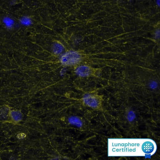 AIF1 Antibody was detected in immersion fixed paraffin-embedded sections of human Brain Cortex using Mouse Anti-Human AIF1, Monoclonal Antibody (Catalog # MAB7308) at 5ug/mL at 37 ° Celsius for 8 minutes. Before incubation with the primary antibody, tissue underwent an all-in-one dewaxing and antigen retrieval preprocessing using PreTreatment Module (PT Module) and Dewax and HIER Buffer H (pH 9; Epredia Catalog # TA-999-DHBH).Tissue was stained using the Alexa Fluor™ 555 Goat anti-Mouse IgG Secondary Antibody at 1:100 at 37 ° Celsius for 2 minutes. (Yellow; Lunaphore Catalog # DR555MS) and counterstained with DAPI (blue; Lunaphore Catalog # DR100). Specific staining was localized to the cytoplasm. Protocol available in COMET™ Panel Builder.