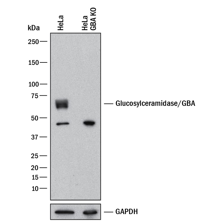 <b>Genetic Strategies Validation. </b>Western blot shows lysates of HeLa human cervical epithelial carcinoma cell line and human GBA knockout HeLa human cervical epithelial carcinoma cell line. PVDF membrane was probed with 1 µg/mL of Mouse Anti-Human Glucosylceramidase/GBA Monoclonal Antibody (Catalog # MAB7410) followed by HRP-conjugated Anti-Mouse IgG Secondary Antibody (HAF007). A specific band was detected for Glucosylceramidase/GBA at approximately 65 kDa (as indicated) in the parental HeLa human cervical epithelial carcinoma cell line, but is not detectable in knockout HeLa human cervical epithelial carcinoma cell line. GAPDH (MAB5718) is shown as a loading control. This experiment was conducted under reducing conditions and using Western Blot Buffer Group 1.