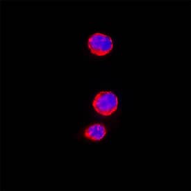 CD163 was detected in fixed Neuro2A cells (Positive) using Rat Anti-Mouse CD163 Monoclonal Antibody (Catalog # MAB7435) at 8 µg/ml for 3 hours at room temperature. Cells were stained using the NorthernLights™ 557-conjugated Anti-Rat IgG Secondary Antibody (red; Catalog # NL013) and counterstained with DAPI (blue). Specific staining was localized to the membrane. View our protocol for Fluorescent ICC Staining of Cells on Coverslips.