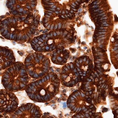 E‑Cadherin was detected in perfusion fixed paraffin-embedded sections of mouse colon using Rat Anti-Mouse E‑Cadherin Monoclonal Antibody (Catalog # MAB7481) at 5 µg/ml overnight at 4 &deg;C. Before incubation with the primary antibody, tissue was subjected to heat-induced epitope retrieval using VisUCyte Antigen Retrieval Reagent-Basic (VCTS021). Tissue was stained using the HRP-conjugated Anti-Rat IgG Secondary Antibody (HAF005) and counterstained with hematoxylin (blue). Specific staining was localized to the membrane. View our protocol for Chromogenic IHC Staining of Paraffin-embedded Tissue Sections.