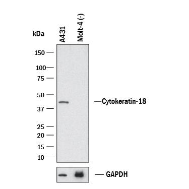 Western Blot Cytokeratin 18 Antibody (810811) [Unconjugated]