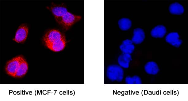 Immunocytochemistry FGFR3 Antibody (136312) [Unconjugated] - (IIIc)