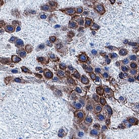 Immunohistochemistry PlGF-3 Antibody (1039018) [Unconjugated]