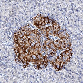 Immunohistochemistry Neuronal Pentraxin 2 Antibody (569720) [Unconjugated]