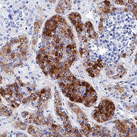 Immunohistochemistry Neuronal Pentraxin 2 Antibody (569720) [Unconjugated]