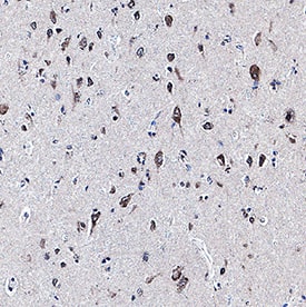 Neurogranin was detected in immersion fixed paraffin-embedded sections of human brain (cortex) using Mouse Anti-Human Neurogranin Monoclonal Antibody (Catalog # MAB79472) at 3 µg/mL for 1 hour at room temperature followed by incubation with the Anti-Rabbit IgG VisUCyte™ HRP Polymer Antibody (VC003). Before incubation with the primary antibody, tissue was subjected to heat-induced epitope retrieval using Antigen Retrieval Reagent-Basic (CTS013). Tissue was stained using DAB (brown) and counterstained with hematoxylin (blue). Specific staining was localized to cytoplasm in neurons. Staining was performed using our protocol for IHC Staining with VisUCyte HRP Polymer Detection Reagents.