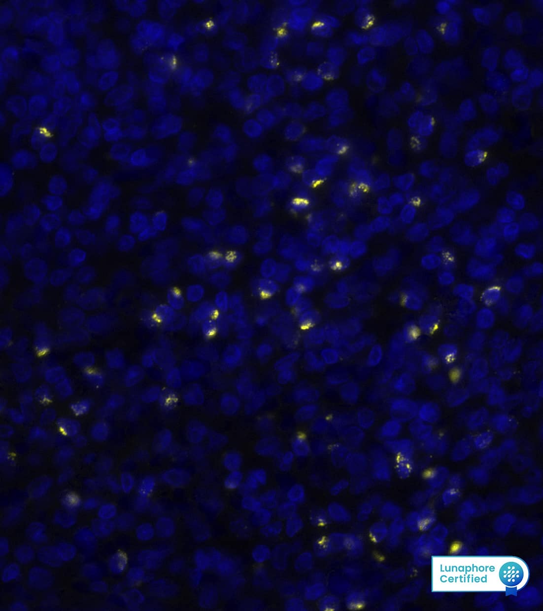Perforin-1 was detected in immersion fixed paraffin-embedded sections of human Spleen using Mouse Anti-Human Perforin-1, Monoclonal Antibody (Catalog #MAB8011) at a 1ug/mL concentration at 37 ° Celsius for 4 minutes. Before incubation with the primary antibody, tissue underwent an all-in-one dewaxing and antigen retrieval preprocessing using PreTreatment Module (PT Module) and Dewax and HIER Buffer H (pH 9; Epredia Catalog # TA-999-DHBH). Tissue was stained using the Alexa Fluor™ 647 Goat anti-Mouse IgG Secondary Antibody at 1:200 at 37 ° Celsius for 2 minutes. (Yellow; Lunaphore Catalog # DR647MS) and counterstained with DAPI (blue; Lunaphore Catalog # DR100). Specific staining was localized to the membrane and cytoplasm. Protocol available in COMET™ Panel Builder.