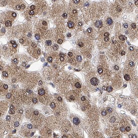 Immunohistochemistry p62/SQSTM1 Antibody (864807) [Unconjugated]