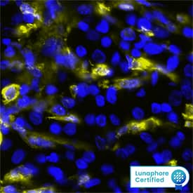 Gelsolin/GSN was detected in immersion fixed paraffin-embedded sections of human Renal Cell Carcinoma using Mouse Anti-Human Gelsolin/GSN, pan Monoclonal Antibody (Catalog # MAB8170) at 20ug/mL at 37 ° Celsius for 4 minutes. Before incubation with the primary antibody, tissue underwent an all-in-one dewaxing and antigen retrieval preprocessing using PreTreatment Module (PT Module) and Dewax and HIER Buffer H (pH 9; Epredia Catalog # TA-999-DHBH).Tissue was stained using the Alexa Fluor™ 647 Goat anti-Mouse IgG Secondary Antibody at 1:200 at 37 ° Celsius for 2 minutes. (Yellow; Lunaphore Catalog # DR647MS) and counterstained with DAPI (blue; Lunaphore Catalog # DR100). Specific staining was localized to the cytoplasm. Protocol available in COMET™ Panel Builder.