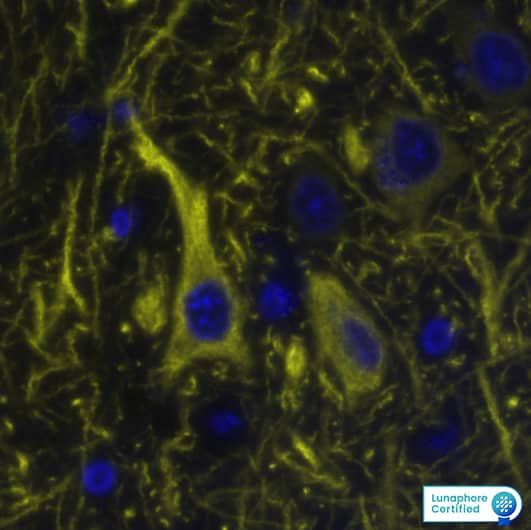 MAP2 Antibody was detected in immersion fixed paraffin-embedded sections of human Brain Cortex using Mouse Anti-Human MAP2, Monoclonal Antibody (Catalog # MAB8304) at 20ug/mL at 37 ° Celsius for 8 minutes. Before incubation with the primary antibody, tissue underwent an all-in-one dewaxing and antigen retrieval preprocessing using PreTreatment Module (PT Module) and Dewax and HIER Buffer H (pH 9; Epredia Catalog # TA-999-DHBH). Tissue was stained using the Alexa Fluor™ 647 Goat anti-Mouse IgG Secondary Antibody at 1:200 at 37 ° Celsius for 2 minutes. (Yellow; Lunaphore Catalog # DR647MS) and counterstained with DAPI (blue; Lunaphore Catalog # DR100). Specific staining was localized to the cytoplasm. Protocol available in COMET™ Panel Builder.​