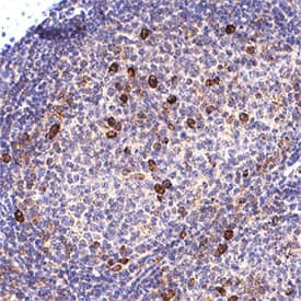 AICL/CLEC-2B was detected in Formalin fixed paraffin-embedded sections of Human Tonsil using Mouse Anti-Human AICL/CLEC-2B Monoclonal Antibody (Catalog # MAB90591) at 5 µg/ml for 1 hour at room temperature followed by incubation with the Anti-Mouse IgG VisUCyte™ HRP Polymer Antibody (Catalog # VC001). Before incubation with the primary antibody, tissue was subjected to heat-induced epitope retrieval using VisUCyte Antigen Retrieval Reagent-Basic (Catalog # VCTS021). Tissue was stained using DAB (brown) and counterstained with Hematoxylin (blue). Specific staining was localized to Cytoplasmic. View our protocol for Chromogenic IHC Staining of Paraffin-embedded Tissue Sections.