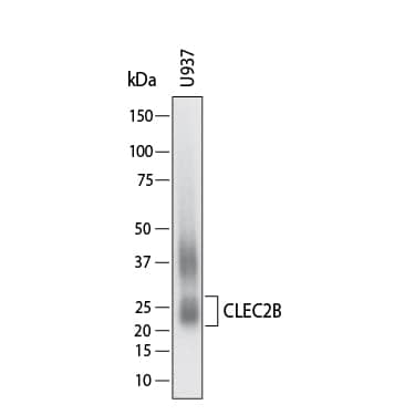 Western Blot AICL/CLEC-2B Antibody (1064941) [Unconjugated]