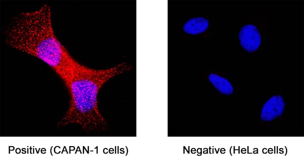 MMP‑7 was detected in immersion fixed Capan‑1 human pancreatic adenocarcinoma cell line (positive staining) and HeLa human cervical epithelial carcinoma cell line (negative control) using Mouse Anti-Human MMP‑7 Monoclonal Antibody (Catalog # MAB9073) at 8 µg/mL for 3 hours at room temperature. Cells were stained using the NorthernLights™ 557-conjugated Anti-Mouse IgG Secondary Antibody (red; NL007) and counterstained with DAPI (blue). Specific staining was localized to cytoplasm. Staining was performed using our protocol for Fluorescent ICC Staining of Non-adherent Cells.