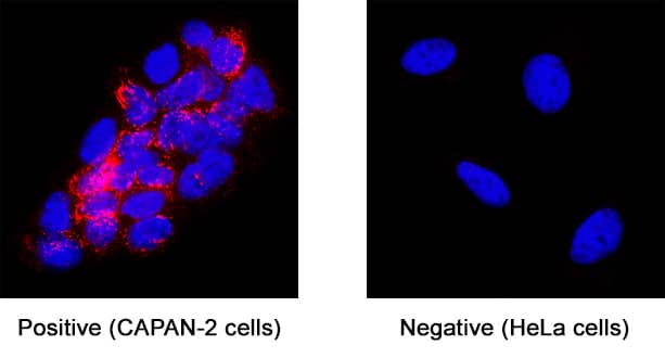 MMP‑7 was detected in immersion fixed Capan‑1 human pancreatic adenocarcinoma cell line (positive staining) and HeLa human cervical epithelial carcinoma cell line (negative control) using Mouse Anti-Human MMP‑7 Monoclonal Antibody (Catalog # MAB9074) at 8 µg/mL for 3 hours at room temperature. Cells were stained using the NorthernLights™ 557-conjugated Anti-Mouse IgG Secondary Antibody (red; NL007)) and counterstained with DAPI (blue). Specific staining was localized to cytoplasm. Staining was performed using our protocol for Fluorescent ICC Staining of Non-adherent Cells.