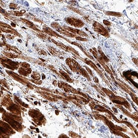  alpha -Cardiac Actin was detected in immersion fixed paraffin-embedded sections of human heart using Mouse Anti-Human/Mouse/Rat  alpha -Cardiac Actin Monoclonal Antibody (Catalog # MAB93081) at 1.7 &micro;g/mL for 1 hour at room temperature followed by incubation with the Anti-Mouse IgG VisUCyte&trade; HRP Polymer Antibody (VC001). Before incubation with the primary antibody, tissue was subjected to heat-induced epitope retrieval using Antigen Retrieval Reagent-Basic (CTS013). Tissue was stained using DAB (brown) and counterstained with hematoxylin (blue). Specific staining was localized to cardiomyocytes. Staining was performed using our protocol for IHC Staining with VisUCyte HRP Polymer Detection Reagents.