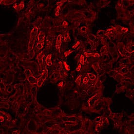 ACE‑2 was detected in immersion fixed frozen sections of rat kidney using Mouse Anti-Human ACE‑2 Monoclonal Antibody (Catalog # MAB9331) at 1 &micro;g/mL overnight at 4 &deg;C. Before incubation with the primary antibody, tissue was subjected to heat-induced epitope retrieval using Antigen Retrieval Reagent-Basic (CTS013). Tissue was stained using the NorthernLights&trade; 557-conjugated Anti-Mouse IgG Secondary Antibody (red; NL007). Specific staining was localized to convoluted tubules. Staining was performed using our protocol for Fluorescent IHC Staining of Frozen Tissue Sections.