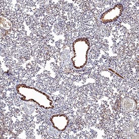 ACE‑2 was detected in immersion fixed paraffin-embedded sections of hamster lung using Mouse Anti-Human ACE‑2 Monoclonal Antibody (Catalog # MAB9331) at 10 &micro;g/mL for 1 hour at room temperature followed by incubation with the Anti-Mouse IgG VisUCyte&trade; HRP Polymer Antibody (VC001). Before incubation with the primary antibody, tissue was subjected to heat-induced epitope retrieval using Antigen Retrieval Reagent-Basic (CTS013). Tissue was stained using DAB (brown) and counterstained with hematoxylin (blue). Specific staining was localized to respiratory bronchioles. Staining was performed using our protocol for IHC Staining with VisUCyte HRP Polymer Detection Reagents.
