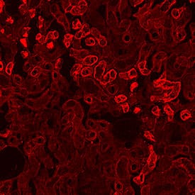 ACE‑2 was detected in immersion fixed frozen sections of rat kidney using Mouse Anti-Human ACE‑2 Monoclonal Antibody (Catalog # MAB9332) at 1 &micro;g/mL overnight at 4 &deg;C. Before incubation with the primary antibody, tissue was subjected to heat-induced epitope retrieval using Antigen Retrieval Reagent-Basic (CTS013). Tissue was stained using the NorthernLights&trade; 557-conjugated Anti-Mouse IgG Secondary Antibody (red; NL007). Specific staining was localized to convoluted tubules. Staining was performed using our protocol for Fluorescent IHC Staining of Frozen Tissue Sections.