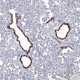 ACE‑2 was detected in immersion fixed paraffin-embedded sections of hamster lung using Mouse Anti-Human ACE‑2 Monoclonal Antibody (Catalog # MAB9332) at 10 &micro;g/mL for 1 hour at room temperature followed by incubation with the Anti-Mouse IgG VisUCyte&trade; HRP Polymer Antibody (VC001). Before incubation with the primary antibody, tissue was subjected to heat-induced epitope retrieval using Antigen Retrieval Reagent-Basic (CTS013). Tissue was stained using DAB (brown) and counterstained with hematoxylin (blue). Specific staining was localized to respiratory bronchioles. Staining was performed using our protocol for IHC Staining with VisUCyte HRP Polymer Detection Reagents.