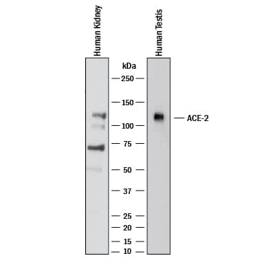 Western blot shows lysates of human kidney and human testis. PVDF membrane was probed with 2 µg/mL of Mouse Anti-Human/Rat/Hamster ACE‑2 Monoclonal Antibody (Catalog # MAB9332) followed by HRP-conjugated Anti-Mouse IgG Secondary Antibody (HAF018). A specific band was detected for ACE‑2 at approximately 120 kDa (as indicated). This experiment was conducted under reducing conditions and using Western Blot Buffer Group 1.