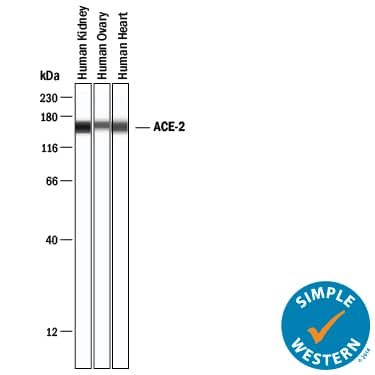 Simple Western lane view shows lysates of human kidney, human ovary and human heart, loaded at 0.2 mg/mL. A specific band was detected for ACE‑2 at approximately 157 kDa (as indicated) using 20 µg/mL of Rabbit Anti-Human ACE‑2 Monoclonal Antibody (Catalog # MAB9337) . This experiment was conducted under reducing conditions and using the 12-230 kDa separation system.