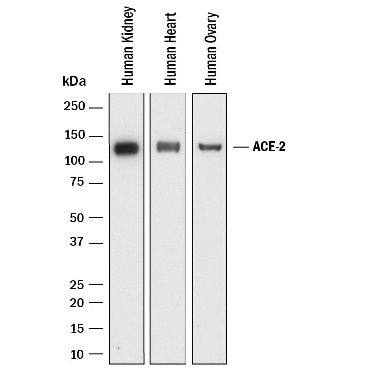 Western blot shows lysates of human kidney, human heart, and human ovary. PVDF membrane was probed with 1 µg/mL of Rabbit Anti-Human ACE‑2 Monoclonal Antibody (Catalog # MAB9337) followed by HRP-conjugated Anti-Rabbit IgG Secondary Antibody (HAF008). A specific band was detected for ACE‑2 at approximately 120 kDa (as indicated). This experiment was conducted under reducing conditions and using Western Blot Buffer Group 1.